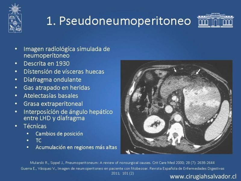 Diapositiva 23 de Caso Clínico