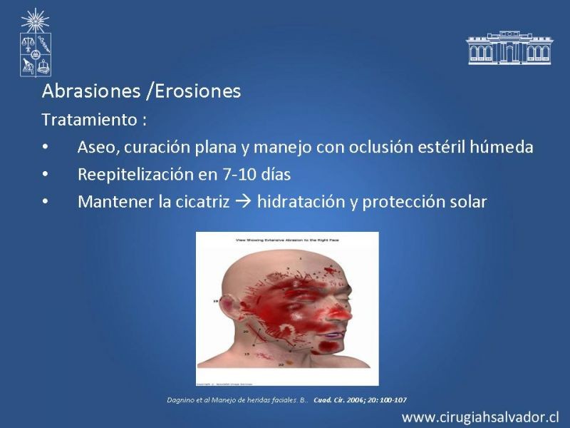 Diapositiva 18 de Trauma Facial: Manejo Quirúrgico de Partes Blandas  