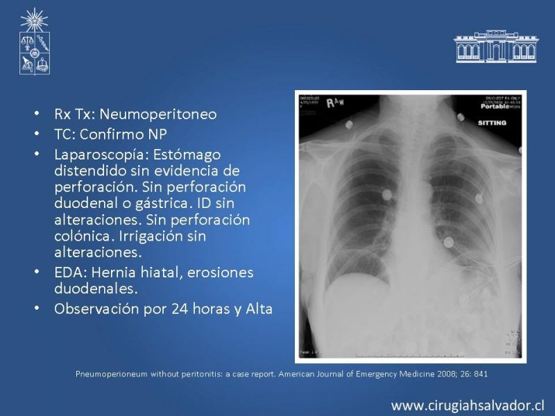 Diapositiva 45 de Caso Clínico