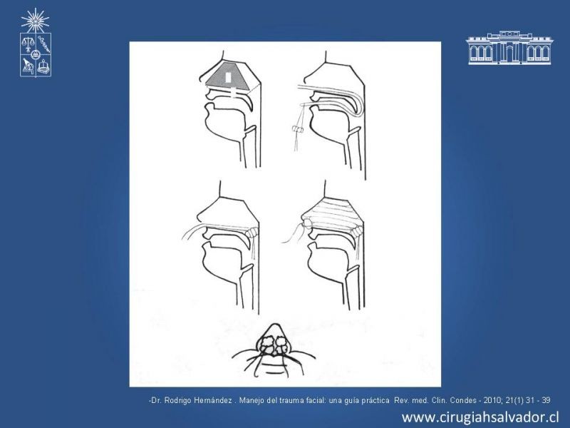 Diapositiva 9 de Trauma Facial: Manejo Quirúrgico de Partes Blandas  