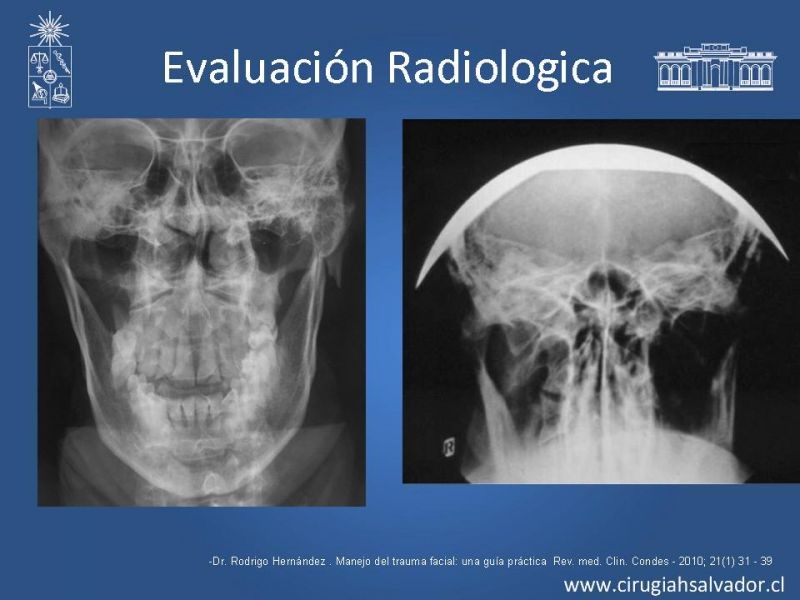 Diapositiva 12 de Trauma Facial: Manejo Quirúrgico de Partes Blandas  