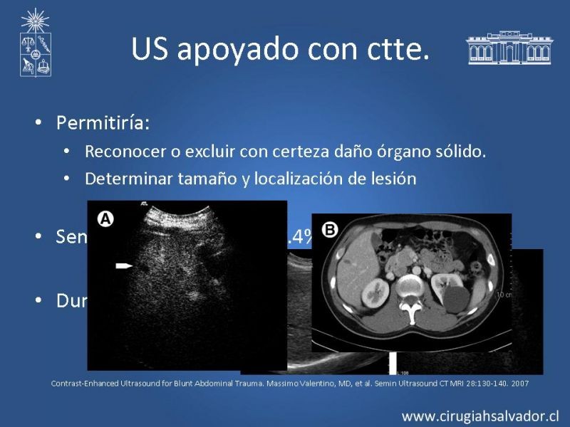 Diapositiva 7 de Imágenes en Trauma Abdominal 