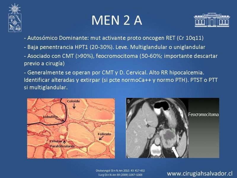 Diapositiva 4 de Hiperparatiroidismo primario