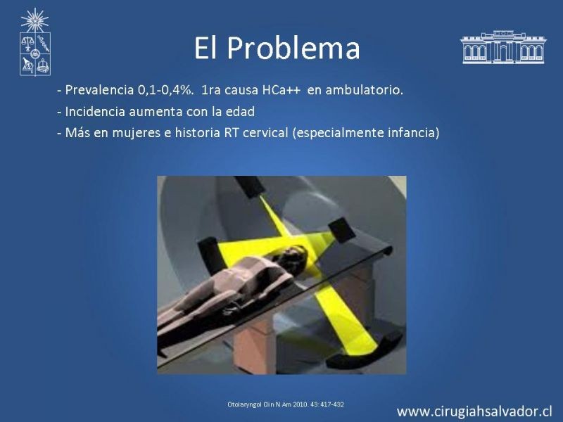 Diapositiva 1 de Hiperparatiroidismo primario