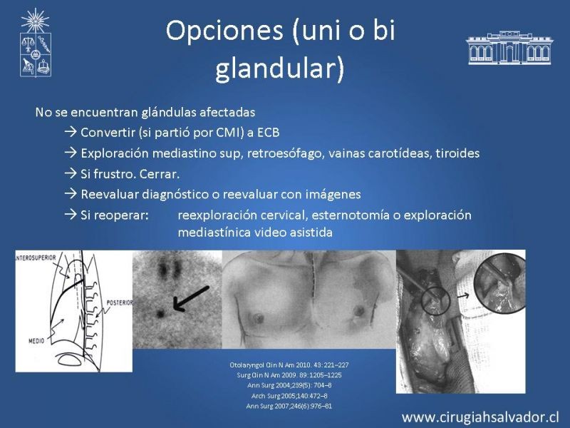 Diapositiva 23 de Hiperparatiroidismo primario
