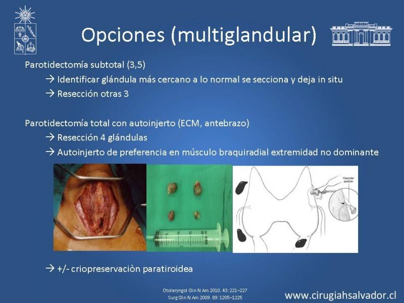 Diapositiva 25 de Hiperparatiroidismo primario