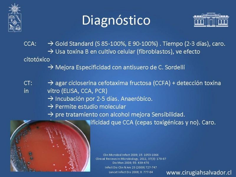 Diapositiva 17 de Diarrea por C. Difficile
