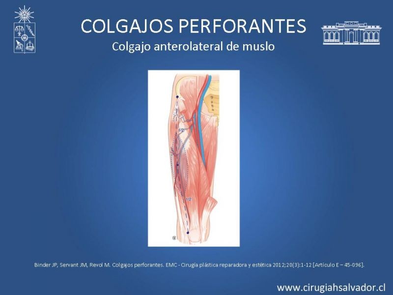 Diapositiva 22 de Colgajos perforantes: Anatomía-usos