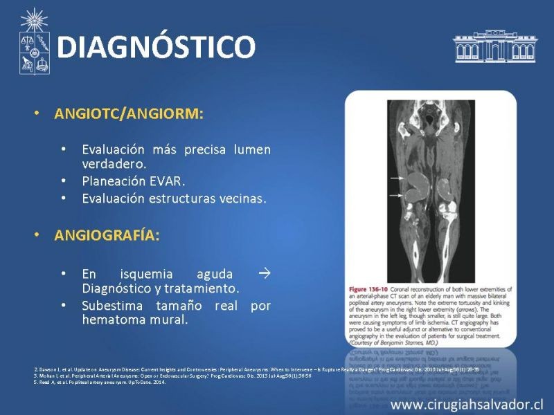 Diapositiva 12 de Aneurismas periféricos