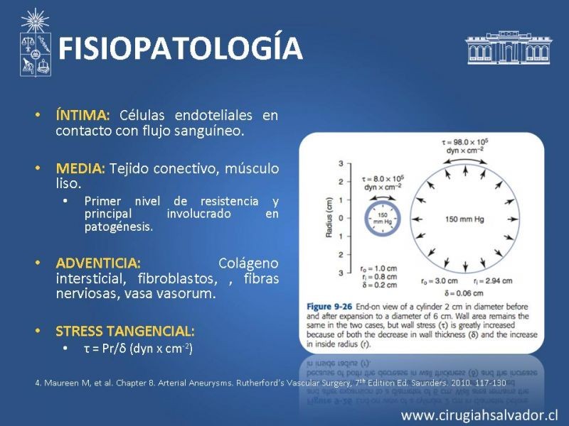 Diapositiva 4 de Aneurismas periféricos