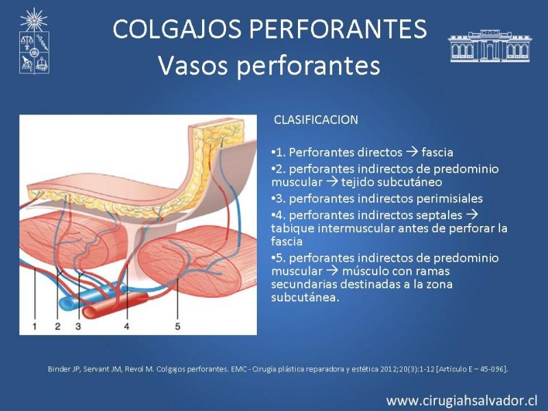 Diapositiva 6 de Colgajos perforantes: Anatomía-usos