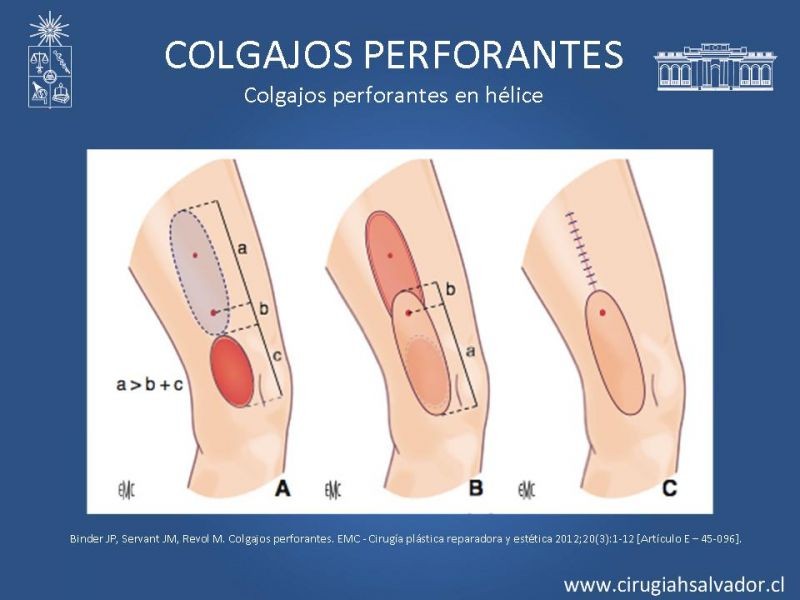 Diapositiva 41 de Colgajos perforantes: Anatomía-usos