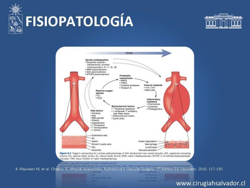 Diapositiva 7 de Aneurismas periféricos