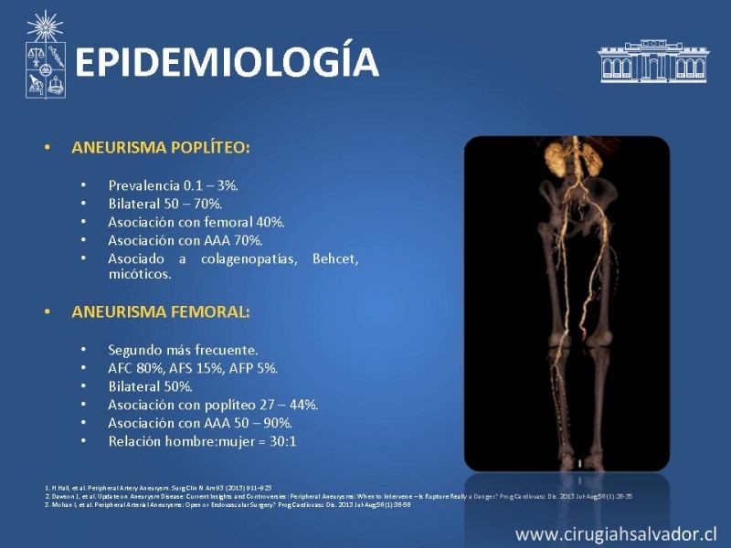 Diapositiva 2 de Aneurismas periféricos