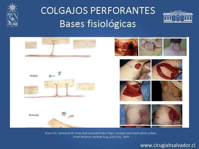 Diapositiva 9 de Colgajos perforantes: Anatomía-usos
