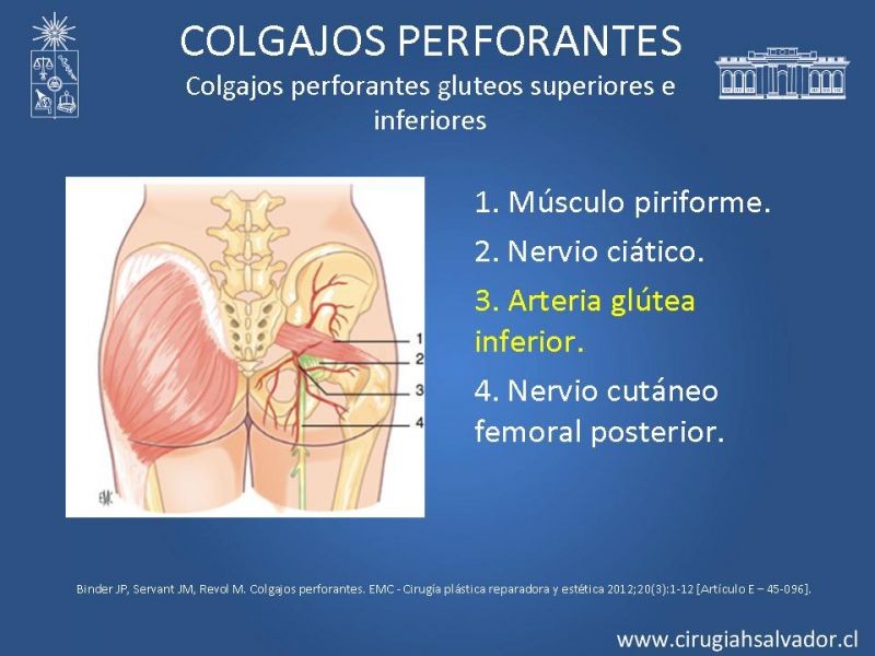 Diapositiva 31 de Colgajos perforantes: Anatomía-usos