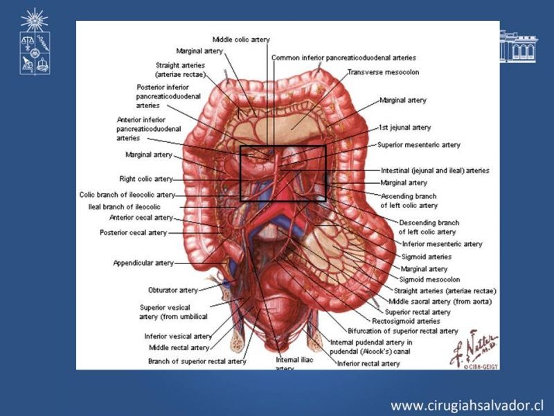 Diapositiva 16 de Lesiones Arteriales de Aorta abdominal e Iliacas 