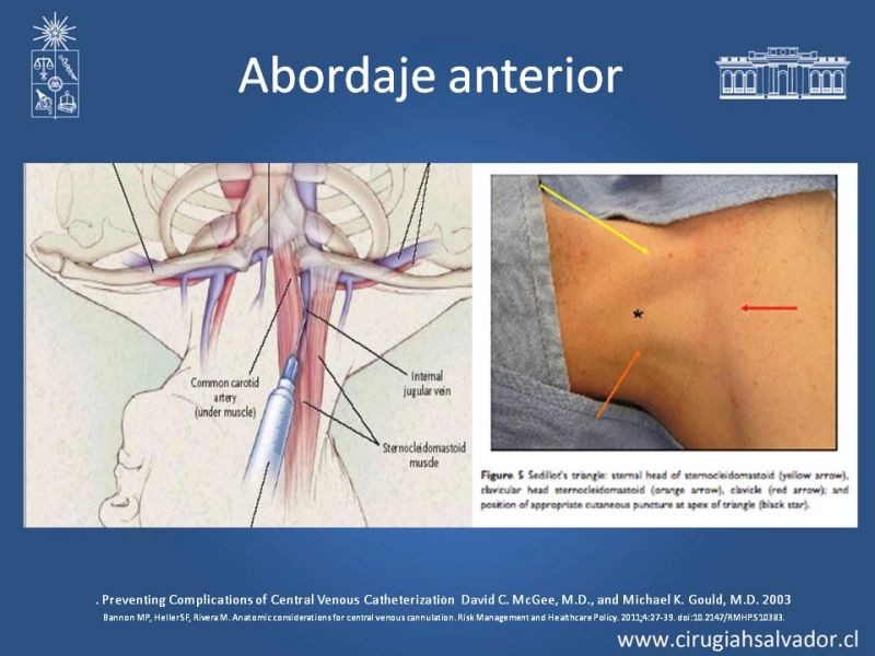 Diapositiva 7 de Accesos Vasculares Centrales