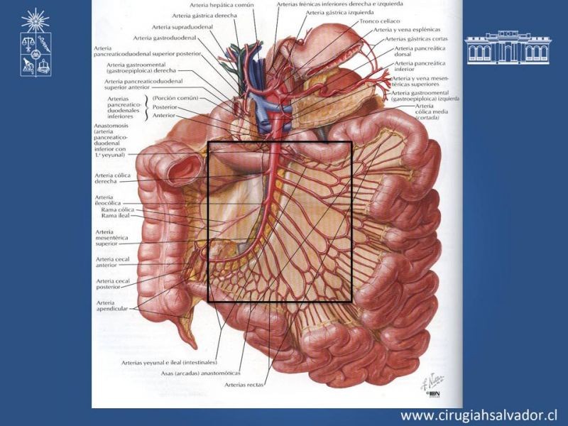 Diapositiva 15 de Lesiones Arteriales de Aorta abdominal e Iliacas 