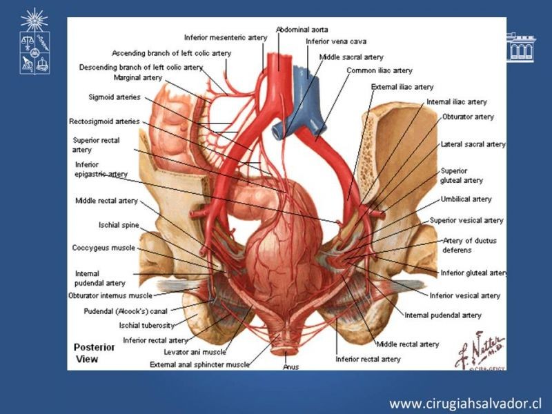 Diapositiva 18 de Lesiones Arteriales de Aorta abdominal e Iliacas 