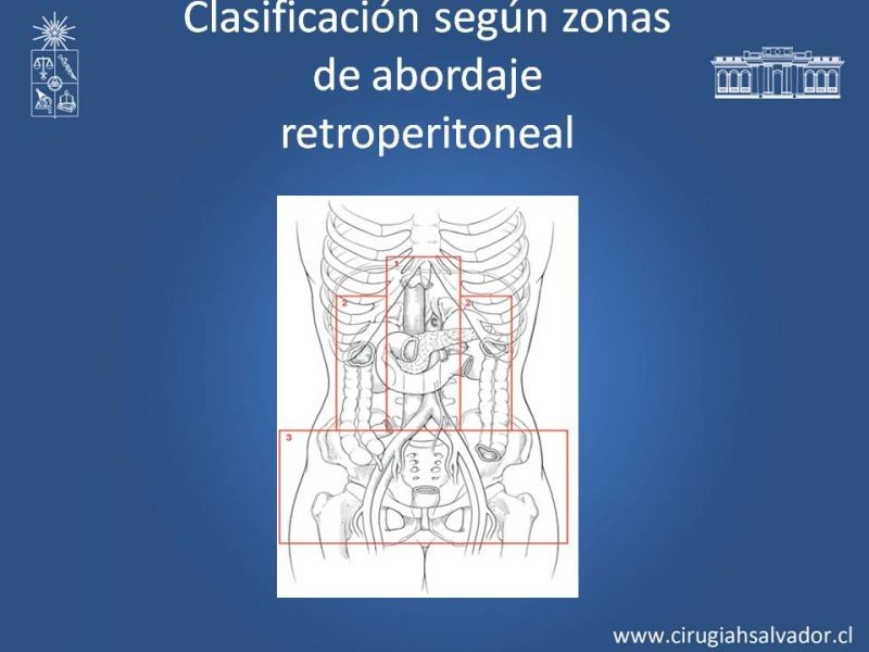 Diapositiva 12 de Lesiones Arteriales de Aorta abdominal e Iliacas 