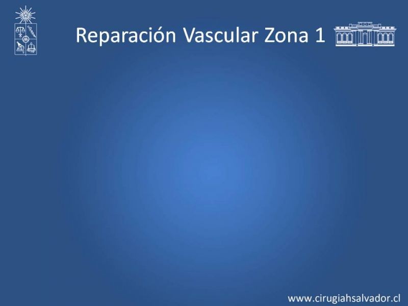 Diapositiva 33 de Lesiones Arteriales de Aorta abdominal e Iliacas 