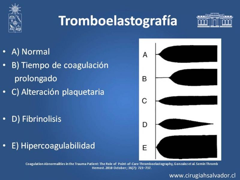 Diapositiva 3 de Transfusiones en trauma