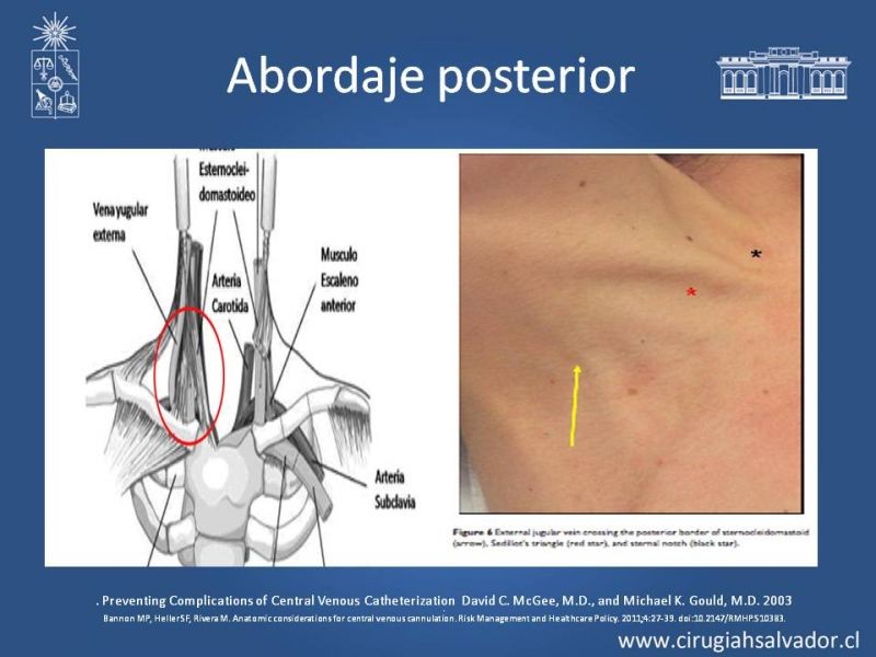 Diapositiva 8 de Accesos Vasculares Centrales
