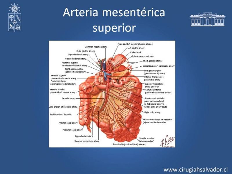 Diapositiva 41 de Lesiones Arteriales de Aorta abdominal e Iliacas 