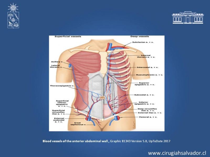 Diapositiva 12 de Laparotomías