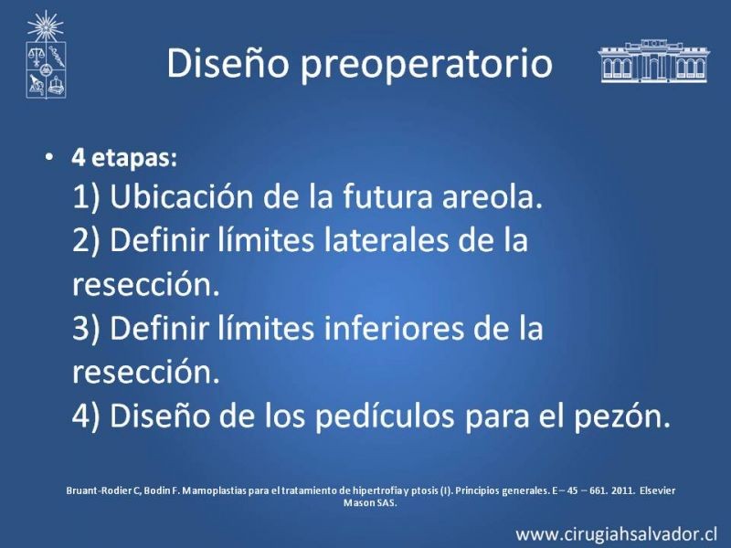 Diapositiva 13 de Reducción Mamaria