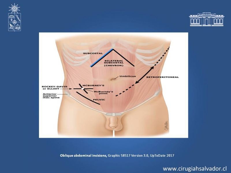 Diapositiva 18 de Laparotomías
