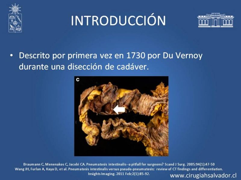 Diapositiva 2 de Neumatosis Intestinal