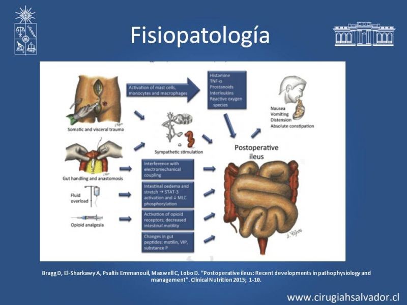 Diapositiva 9 de Ileo postquirúrgico