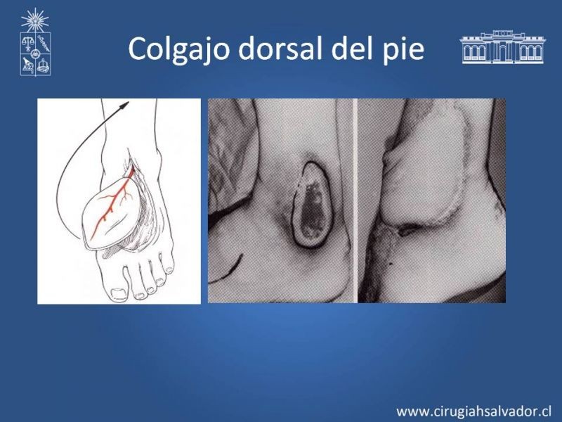 Diapositiva 36 de Reconstrucción de extremidad inferior