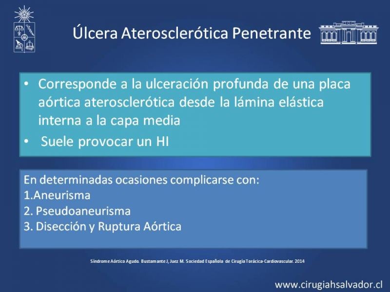 Diapositiva 11 de Síndrome Aórtico Agudo