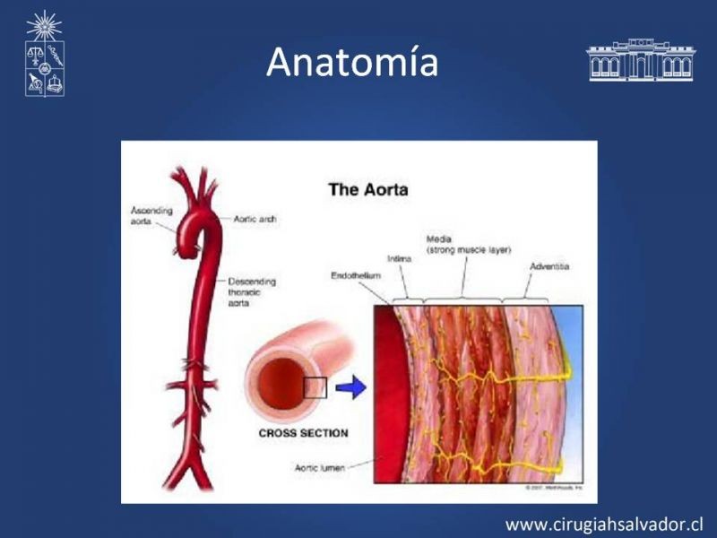 Diapositiva 1 de Síndrome Aórtico Agudo