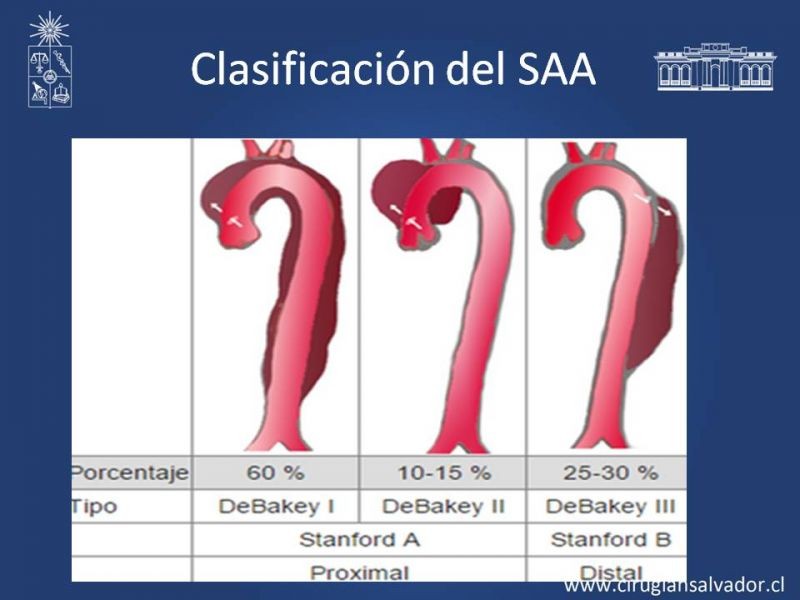 Diapositiva 15 de Síndrome Aórtico Agudo