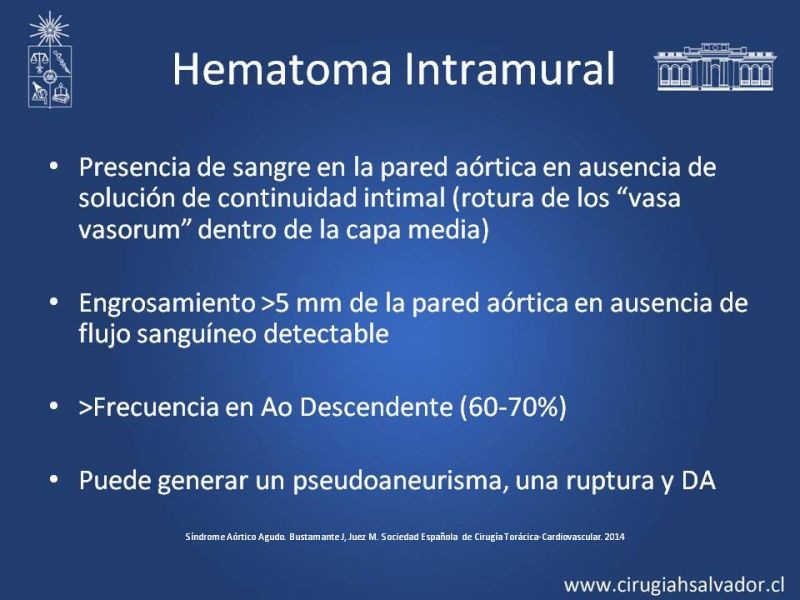 Diapositiva 9 de Síndrome Aórtico Agudo