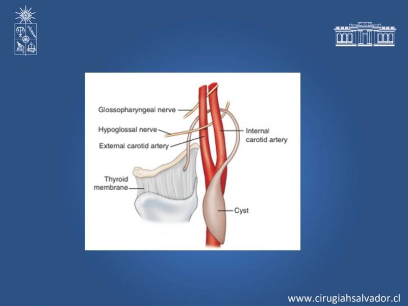 Diapositiva 23 de Quistes Branquiales