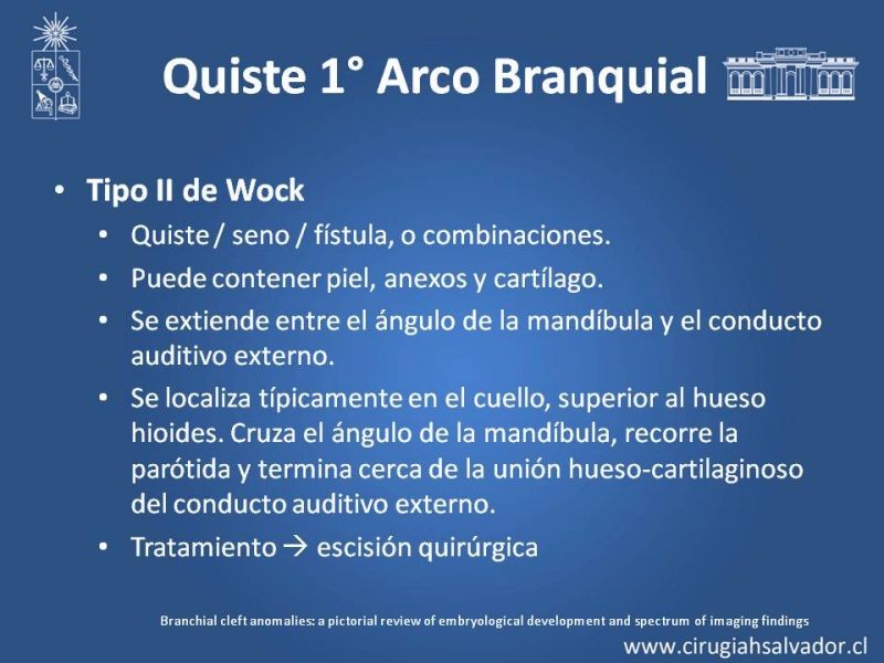 Diapositiva 7 de Quistes Branquiales