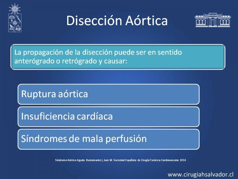 Diapositiva 7 de Síndrome Aórtico Agudo