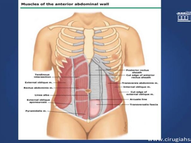 Diapositiva 1 de Cirugía de Separación de Componentes