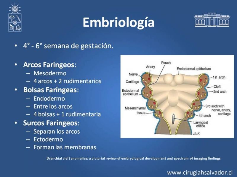 Diapositiva 2 de Quistes Branquiales