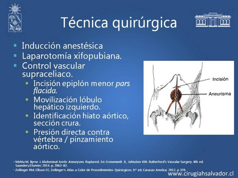 Diapositiva 13 de Aneurisma aórtico abdominal roto