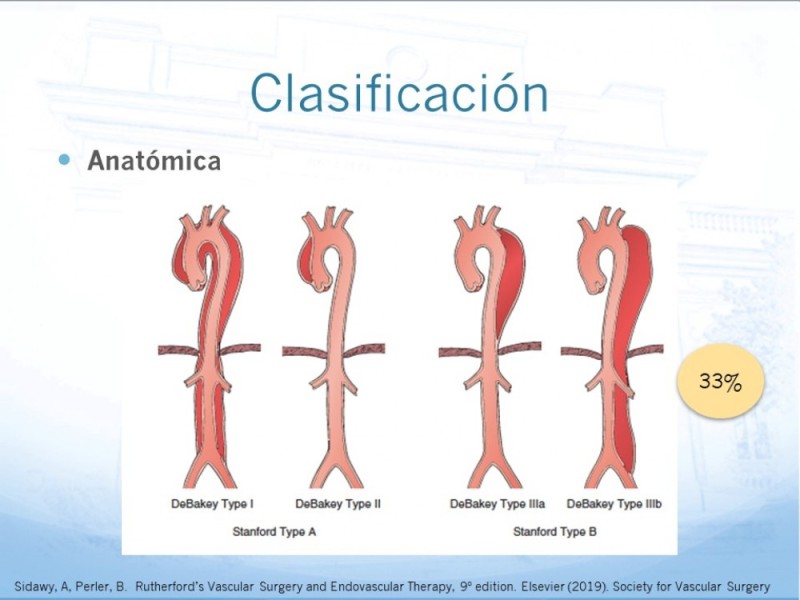 Diapositiva 5 de Manejo de disección aórtica tipo B