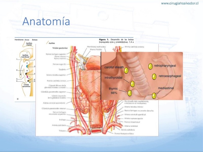 Diapositiva 1 de Hiperparatiroidismo primario