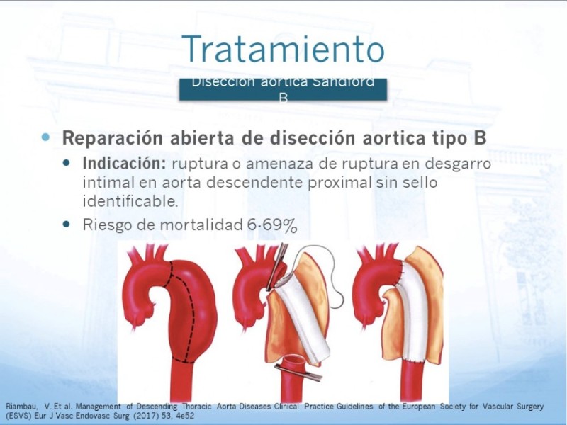 Diapositiva 13 de Manejo de disección aórtica tipo B