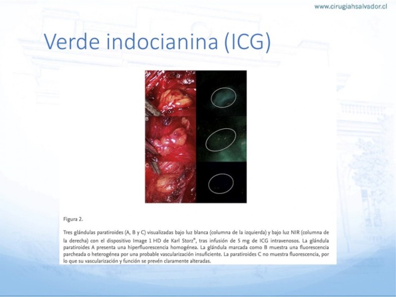 Diapositiva 26 de Hiperparatiroidismo primario