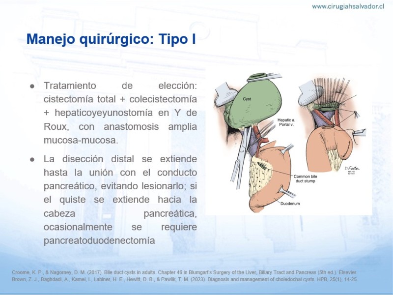 Diapositiva 15 de Quistes de Vía Biliar​